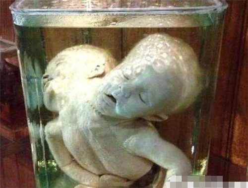 世界上最恐怖的博物館：雙頭尸體，愛(ài)因斯坦大腦切片都在這