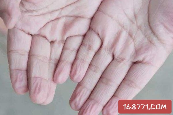 為什么洗澡時手會皺?手部皮下脂肪少(有利于抓握濕物)