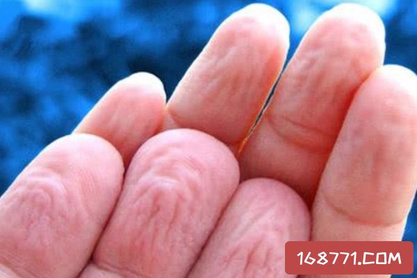 為什么洗澡時手會皺?手部皮下脂肪少(有利于抓握濕物)