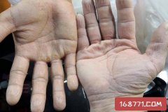 為什么洗澡時手會皺 洗澡時手為什么會皺縮