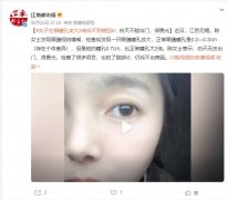 瞳孔放大意味著什么？眼睛模糊怎么辦？